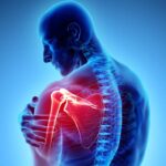 arthritis-page