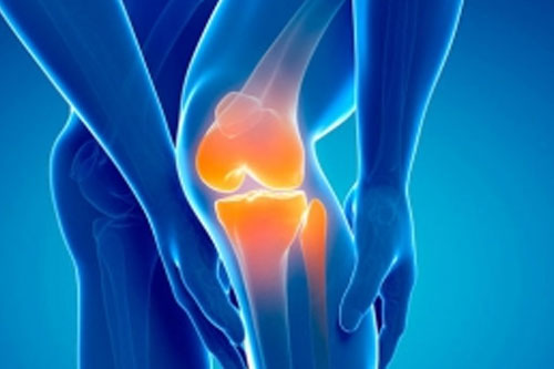 arthritis